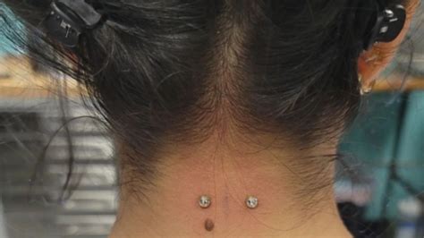 nape piercing|nape piercing before and after.